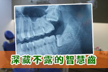深藏不露的智慧齒
