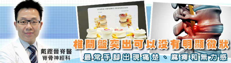 椎間盤突出可以沒有明顯徵狀
最常手腳出現痛楚、麻痺和無力感 椎間盤突出可以沒有明顯徵狀
最常手腳出現痛楚、麻痺和無力感