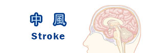 中風 - Stroke