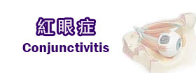 紅眼症 - conjunctivitis