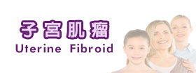 子宮肌瘤 - Uterine Fibroid