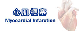 心肌梗塞 - Myocardial Infarction