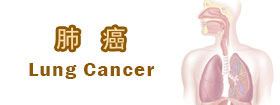 肺癌[Lung Cancer]
