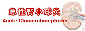 急性腎小球炎 - Acute Glomerulonephritis