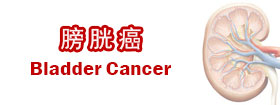 膀胱癌[Bladder Cancer]