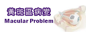黃斑區病變 - Macular problem