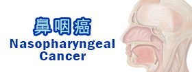 鼻咽癌 - Nasopharyngeal Cancer
