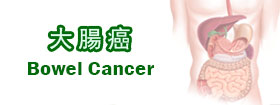 大腸癌 - Bowel Cancer