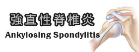 強直性脊椎炎 - Ankylosing Spondylitis