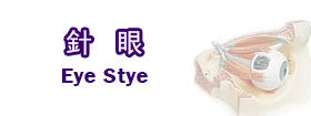 針眼[Eye Stye]