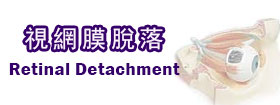 視網膜脫落 - Retinal Detachment