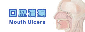 口腔潰瘍 - Mouth Ulcers