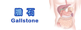 膽石 - Gallstone