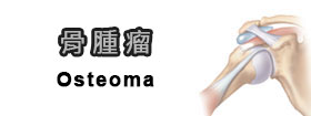 骨腫瘤 - Osteoma
