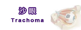 沙眼 - Trachoma