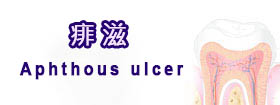 痱滋 - Aphthous Ulcer