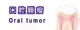 口腔腫瘤 - Oral tumor