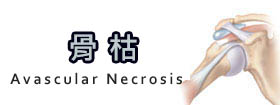 骨枯 - Avascular Necrosis