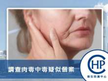 衞生防護中心調查肉毒中毒疑似個案