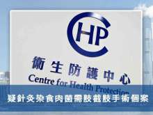 疑針灸染食肉菌需肢截肢手術個案