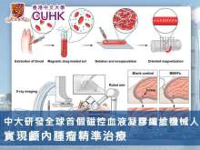 中大研發全球首個磁控血液凝膠機械人 實現顱內腫瘤精準治療