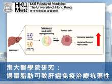 港大醫學院研究：過量脂肪可致肝癌免疫治療抗藥性
