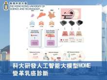 科大研發人工智能大模型MOME 變革乳癌診斷