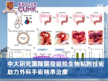 中大研究團隊開發磁控生物粘附技術 助力外科手術精準治療