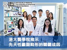 港大醫學院揭示先天性顱顏畸形的關鍵成因